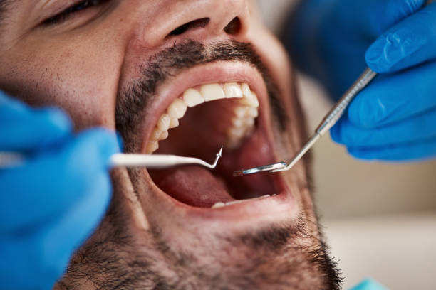 Best Emergency Treatment for Jaw Pain or Injury in Upper Exeter, PA